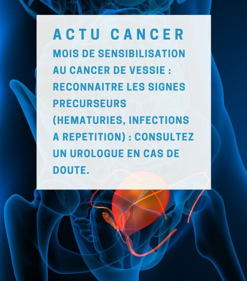 [Actu santé] cancer de la vessie