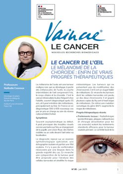 Cancer de l'oeil : Le mélanome de la choroïde : enfin de vrais progrès thérapeutiques