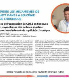Persistance de l’expression de CD63 en lien avec la division asymétrique des cellules souches leucémiques dans la leucémie myéloïde chronique