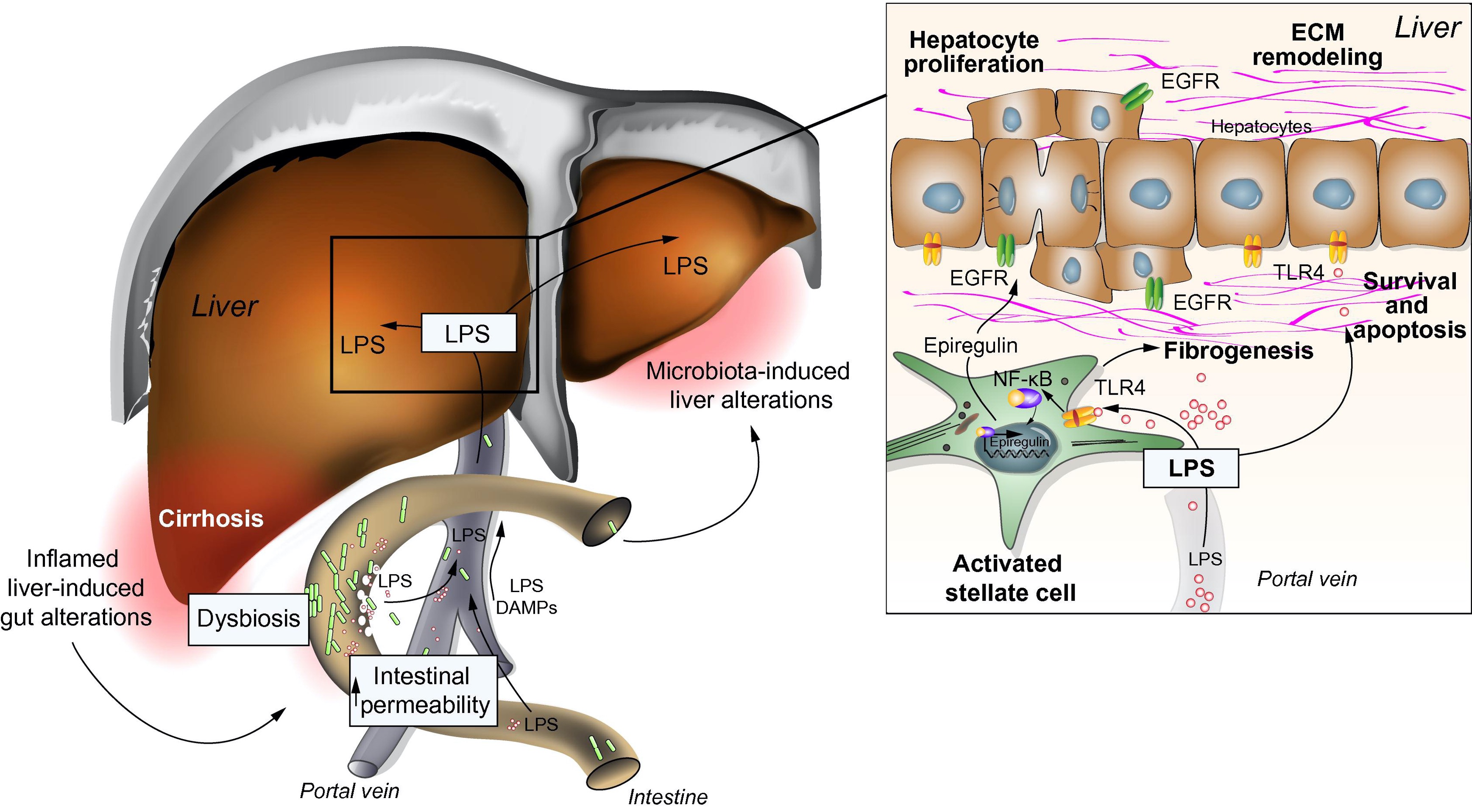 targeting-gut-flora-to-prevent-progression-of-hepatocellular-carcinoma